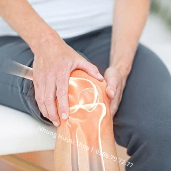 hỗ trợ các bệnh về xương khớp