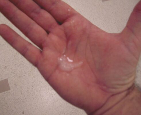 hình ảnh tinh trùng loãng